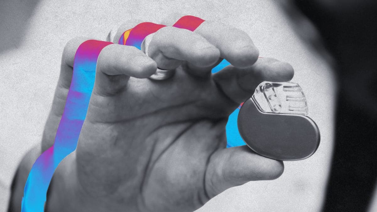 Après une cyberattaque, les nouveaux pacemakers de ce géant de la santé ne peuvent plus transmettre leurs données à distance