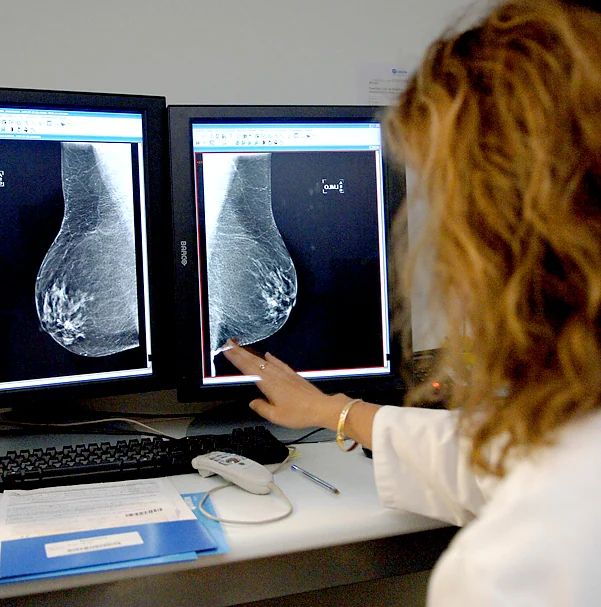 Un 68% de las mujeres de 50 a 69 años declara haberse realizado una mamografía en los últimos dos años, frente al 81,5% en 2017