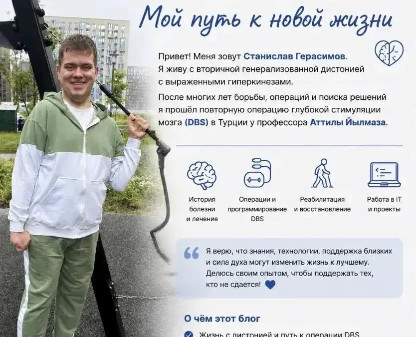 После многих лет борьбы я получил ещё один шанс: Deep Brain Stimulation — Abbott Libberta RC