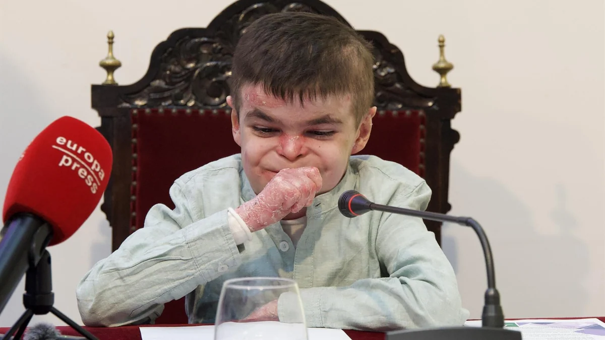 El procedimiento que podría acelerar la llegada del medicamento contra la piel de mariposa a la sanidad pública