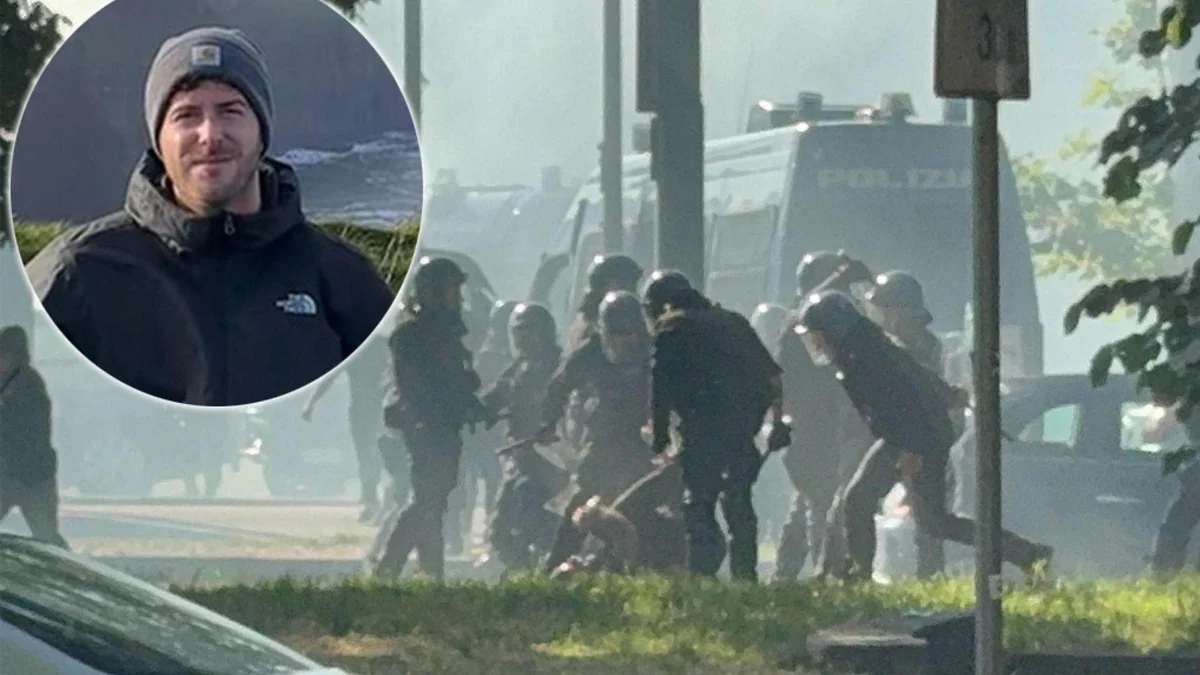 Tifoso ferito al derby, i pm chiedono di arrestare un poliziotto: “L’ha colpito con un lacrimogeno”