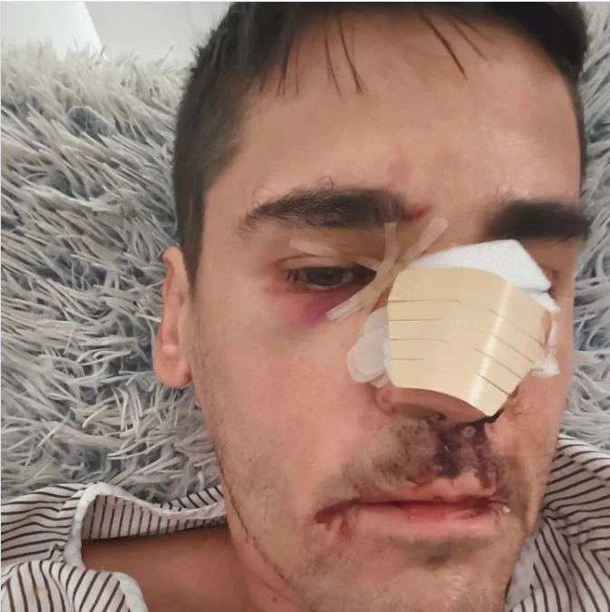El periodista Fonsi Loaiza denuncia una "brutal agresión": "Lo último que recuerdo es que me llamaron 'rojo, subcampeón' antes de quedar inconsciente"