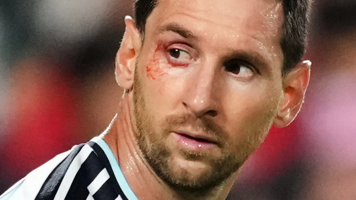 El corte en el ojo que sufrió Lionel Messi durante el duelo entre Argentina y Suiza del Mundial 2026
