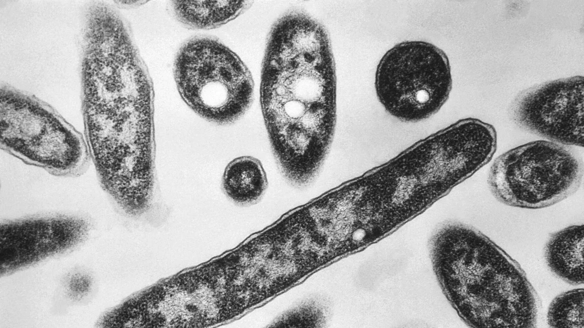 Alerta por brote mortal de Legionella en Nueva York: reportan tercera muerte y estos son los barrios en riesgo