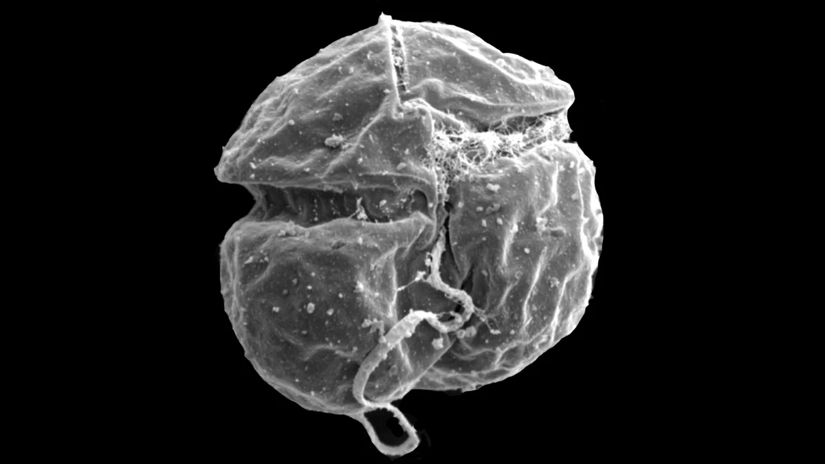 “Desastre natural”: alertan por una microalga tóxica que puso en riesgo la fauna marina en Australia