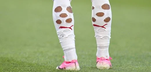Fußball-WM: Nackte Oberschenkel, Löcher in den Stutzen – woher kommen die Macken der WM-Stars?