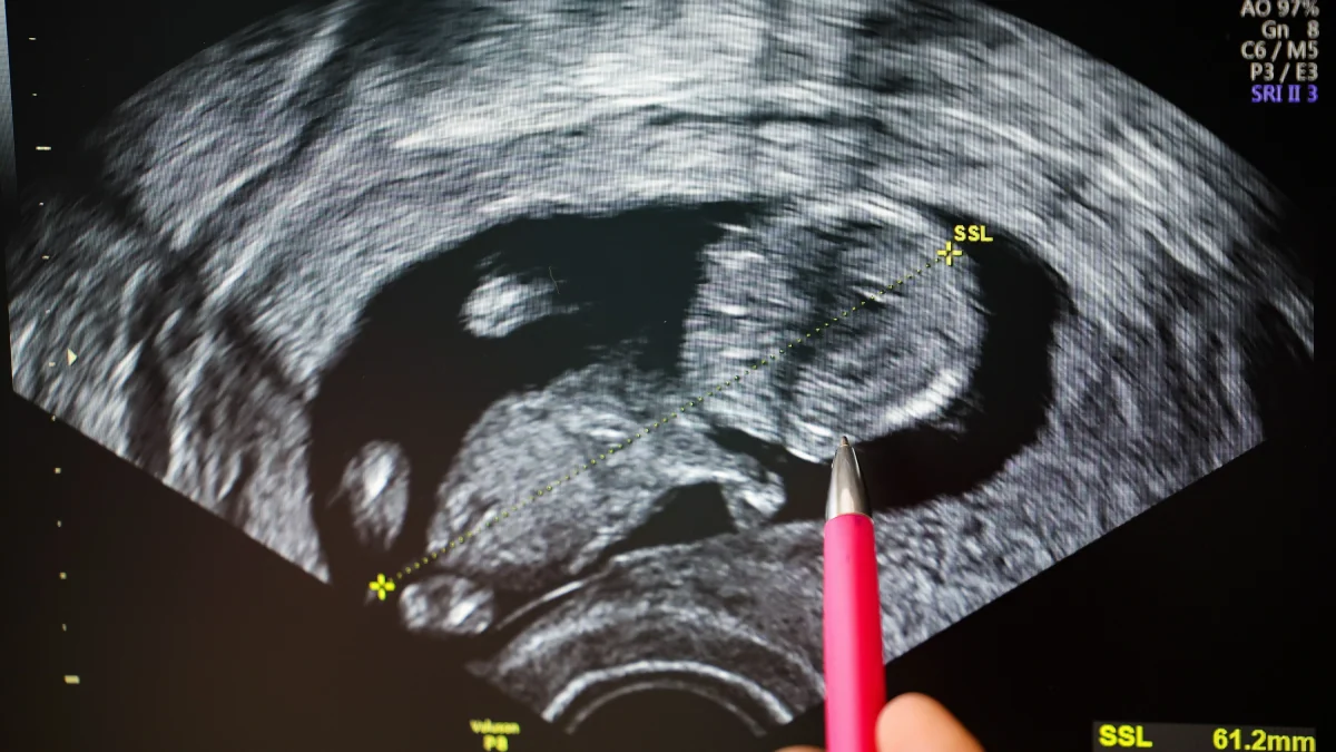 Einspruch Exklusiv: Deutsche Doppelmoral beim Babykauf