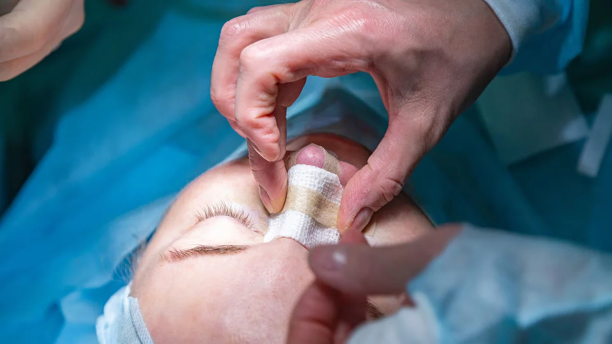 “Me deformó la nariz”: se sometió a una rinoplastia, demandó por mala praxis, pero la Justicia rechazó el reclamo