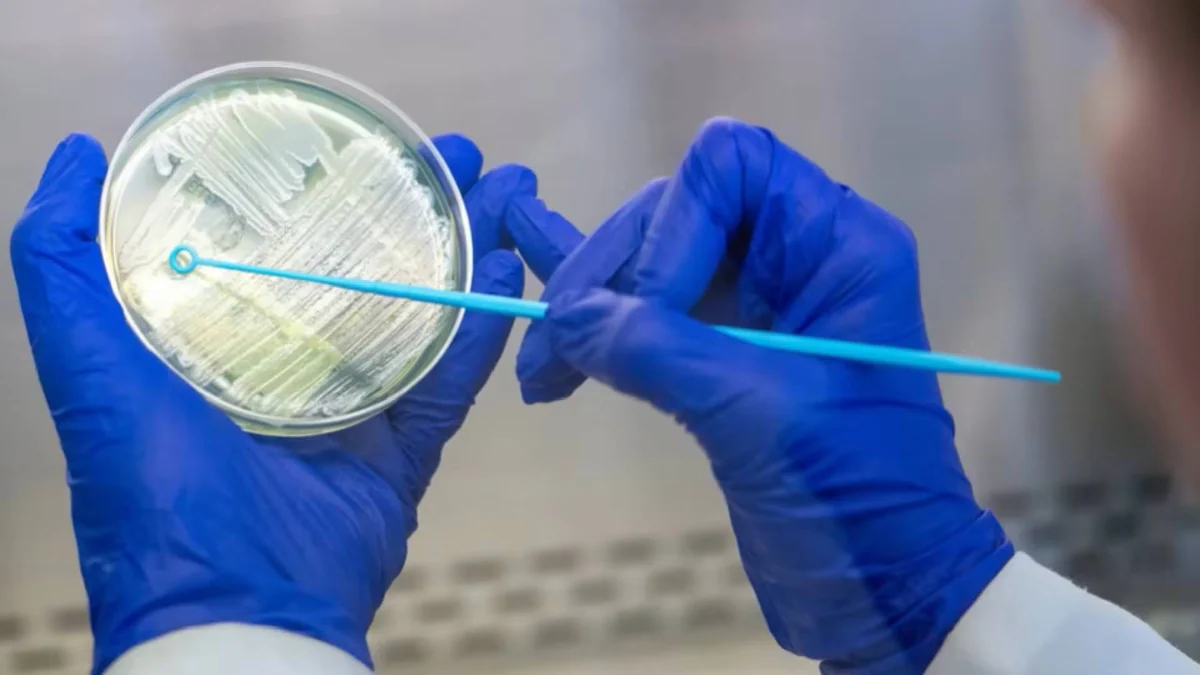 El brote de cyclosporiasis en Michigan supera los 1.000 casos y llega a Ohio: no logran identificar la fuente de contagio