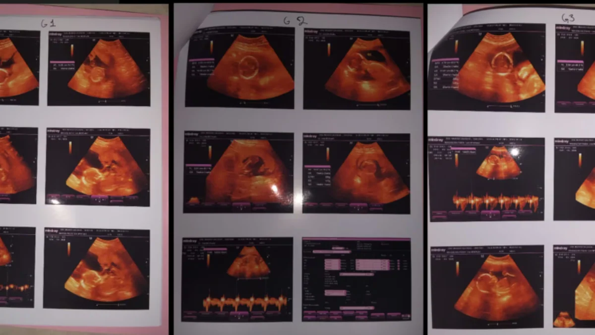 Mamá de trillizas dio a luz en Sinaloa y acusa que no le entregaron a una: esto dijo el hospital