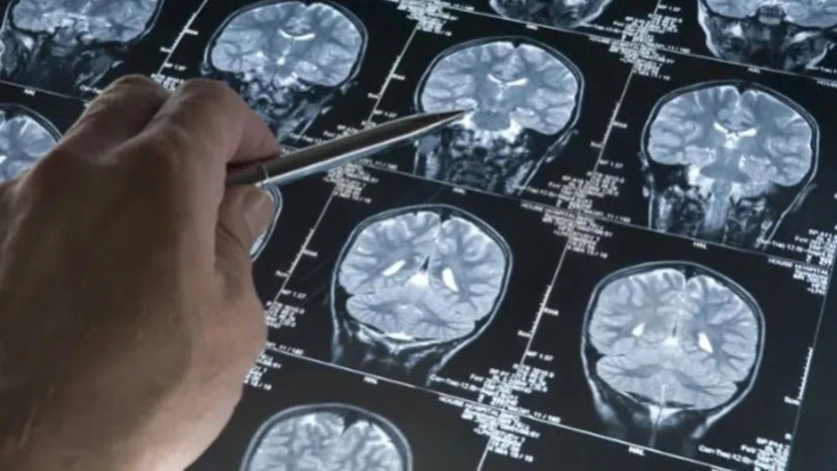 Un estudio reveló qué tipo de deportistas tienen cuatro veces más riesgo de morir por enfermedades neurodegenerativas