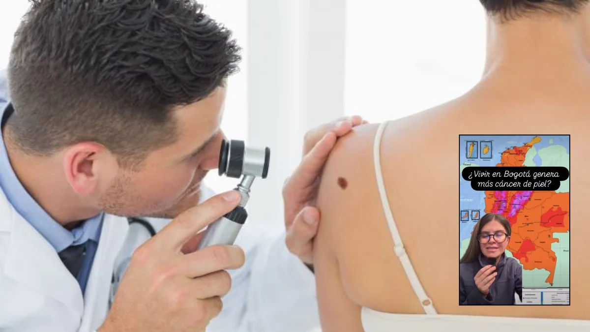 Ojo con el sol, los habitantes de Bogotá tienen mayor riesgo de sufrir cáncer de piel: dermatóloga explica la razón