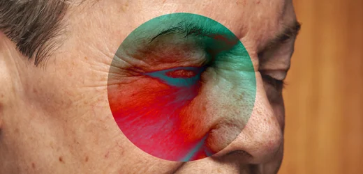Verschwommen sehen: Rätselhafte Patientin sieht plötzlich schlecht – Ursache liegt nicht im Auge