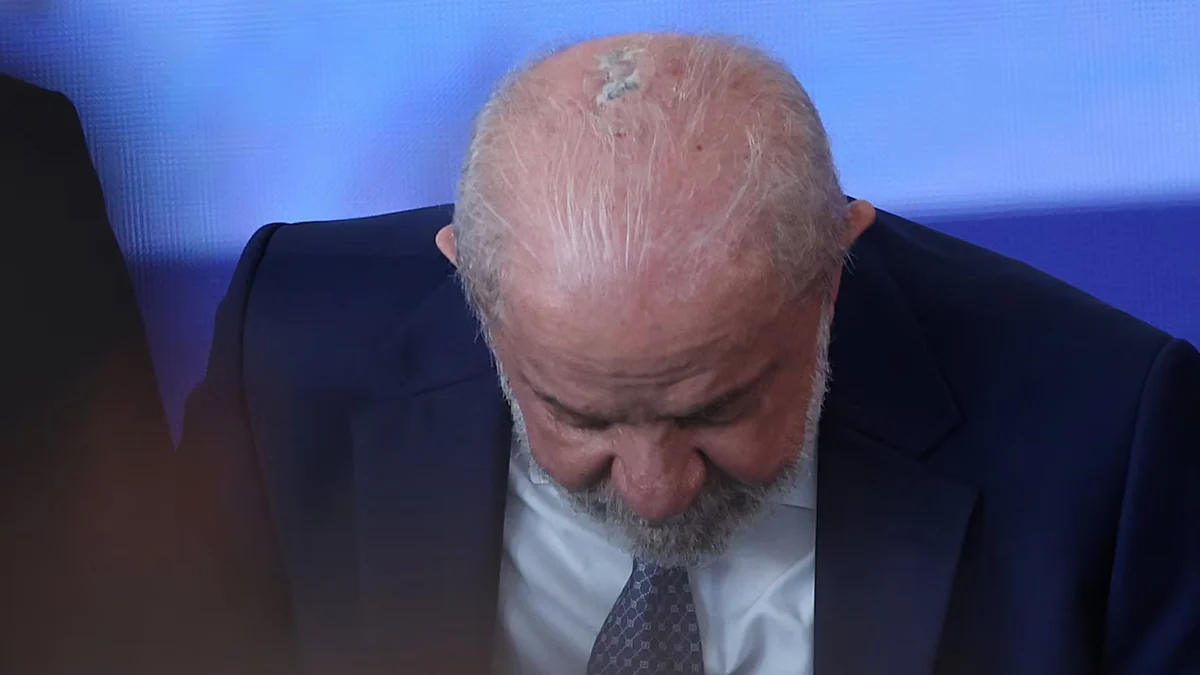 Lula recibe radioterapia preventiva contra el cáncer de piel a cuatro meses de las elecciones en Brasil