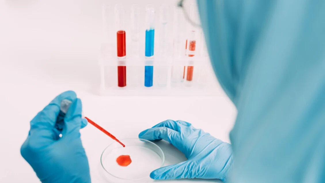 Alzheimer, test su proteina spia del sangue funziona anche per la popolazione asiatica