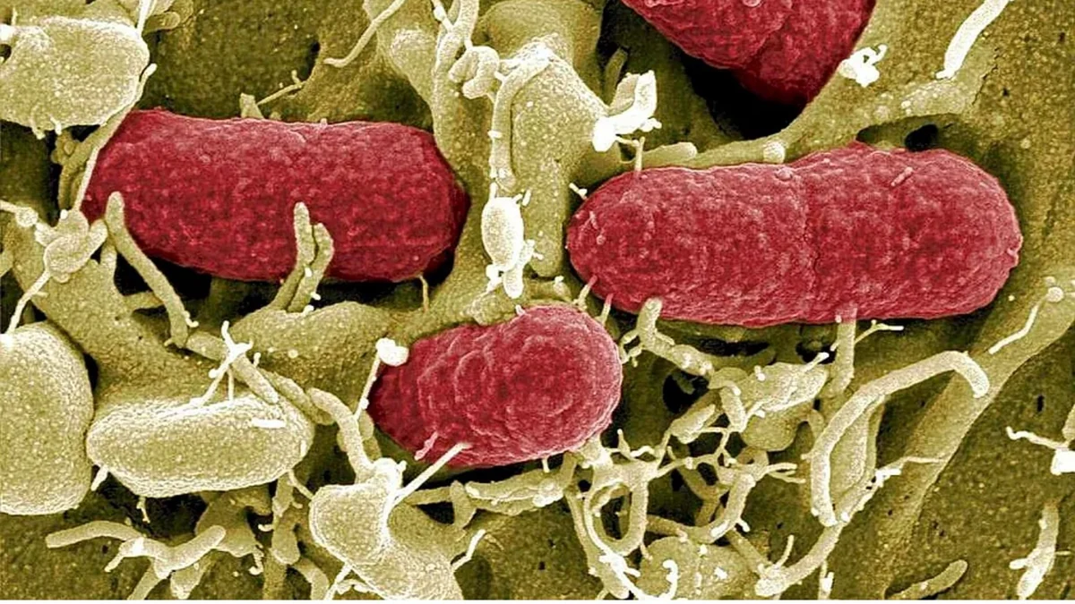 Un antibiótico 'vintage' para luchar contra las infecciones por enterobacterias multirresistentes