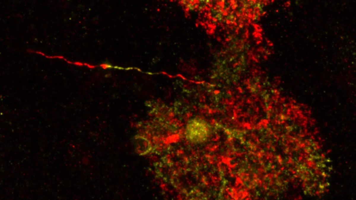 Un estudio internacional con intervención del CSIC halla células cerebrales patológicas hasta ahora consideradas inocuas