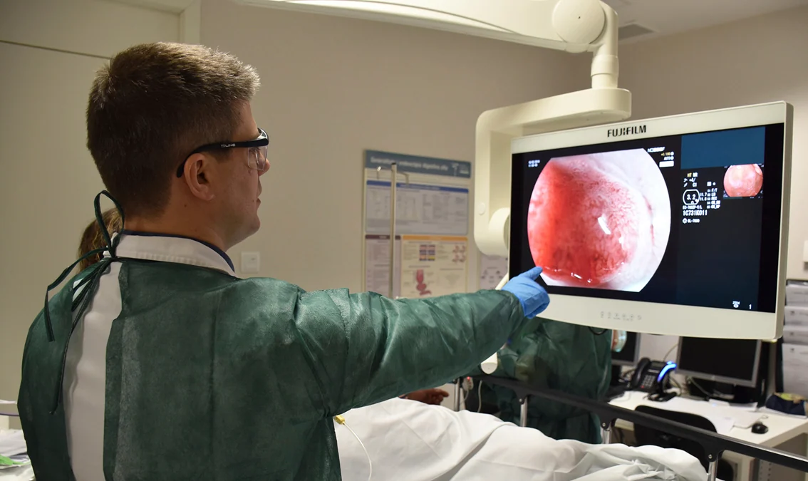 Nuevos test para adelantarse al cáncer de colon