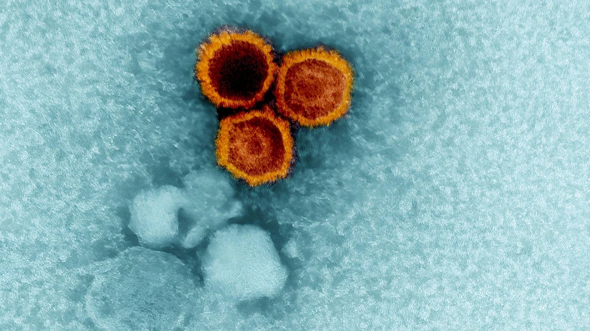 Studie: Wie ein Virus Multiple Sklerose mitauslösen kann