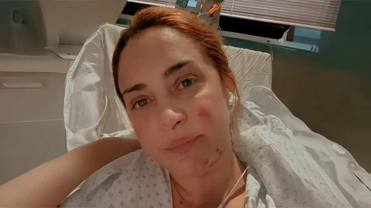 María Julia Oliván, a un año de su accidente: “En ese momento podría haberme muerto”