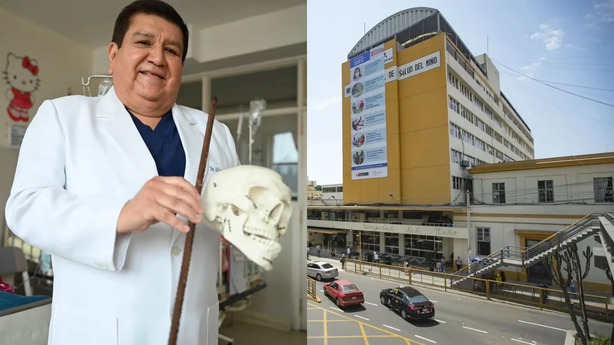 Varilla de construcción de 65 cm atravesó cráneo y cuello de un niño en SJL: quedó incrustada sin quitarle la vida