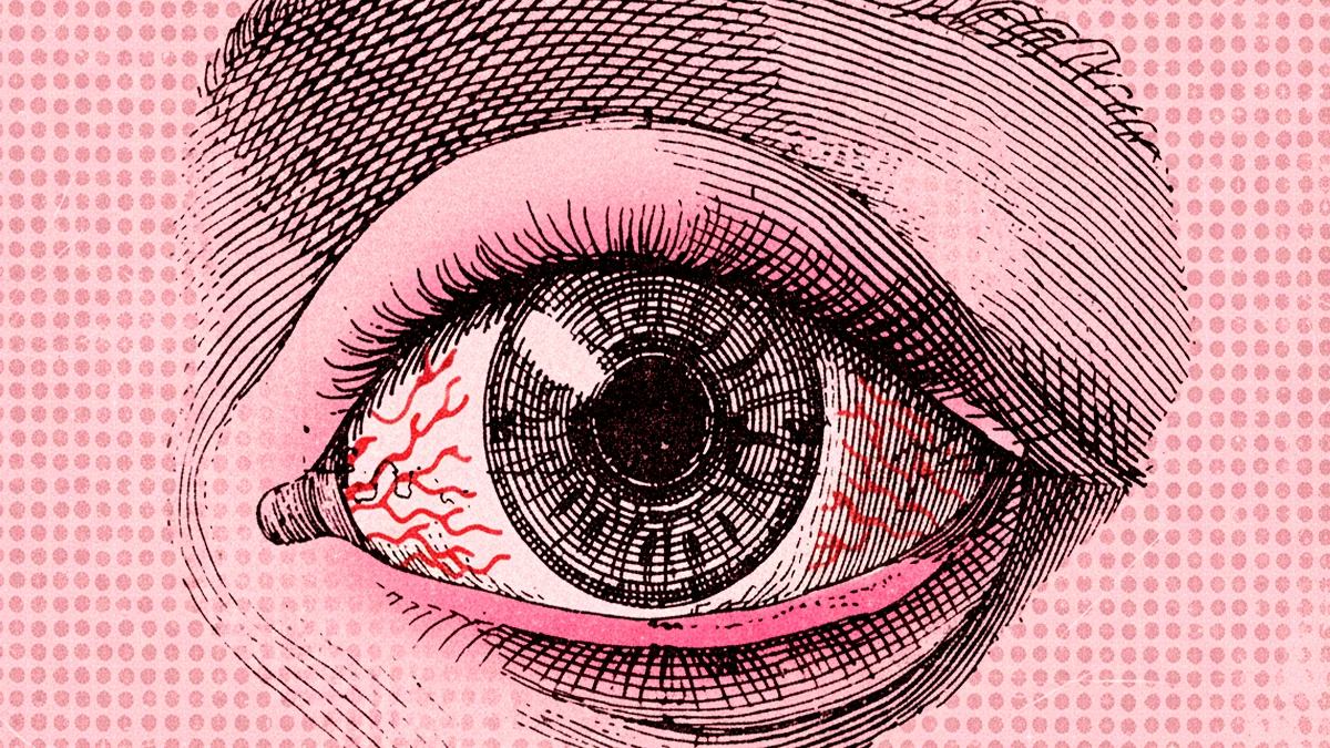 Ni manzanilla, ni otros remedios caseros para afrontar el lagrimeo y picor de ojos síntomas principales de las conjuntivitis