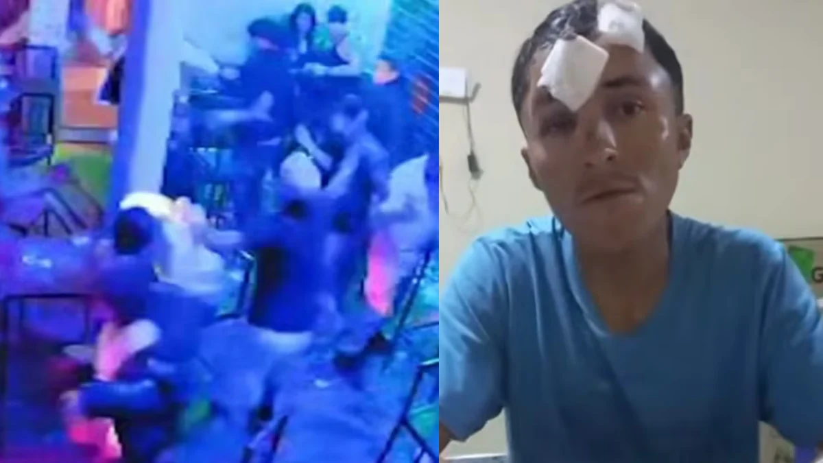 Brutal ataque en restobar de Piura: hombre terminó con 57 puntos en la cabeza tras ser golpeado por siete sujetos