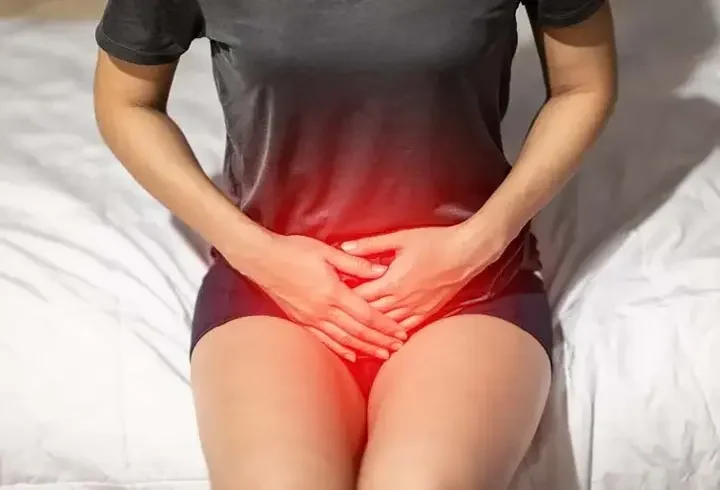 Şiddetli Adet Ağrıları Endometriozis Belirtisi Olabilir mi?